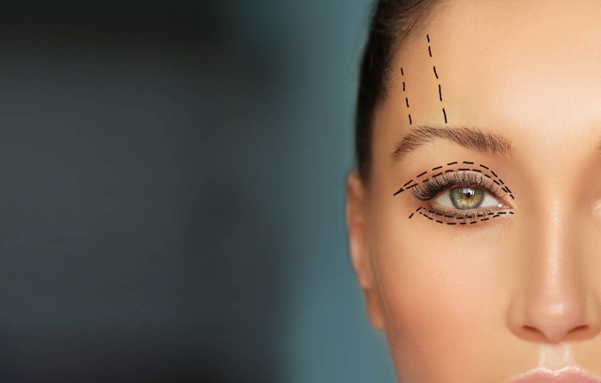 Mắt sụp mí: Nguyên nhân, biểu hiện và cách khắc phục hiệu quả